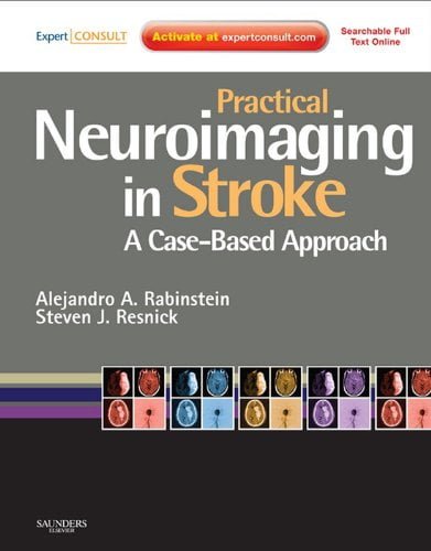  دانلود کتاب Practical Neuroimaging In Stroke - A Case-Based Approach, 2009 - دانلود کتاب های دانشگاهی