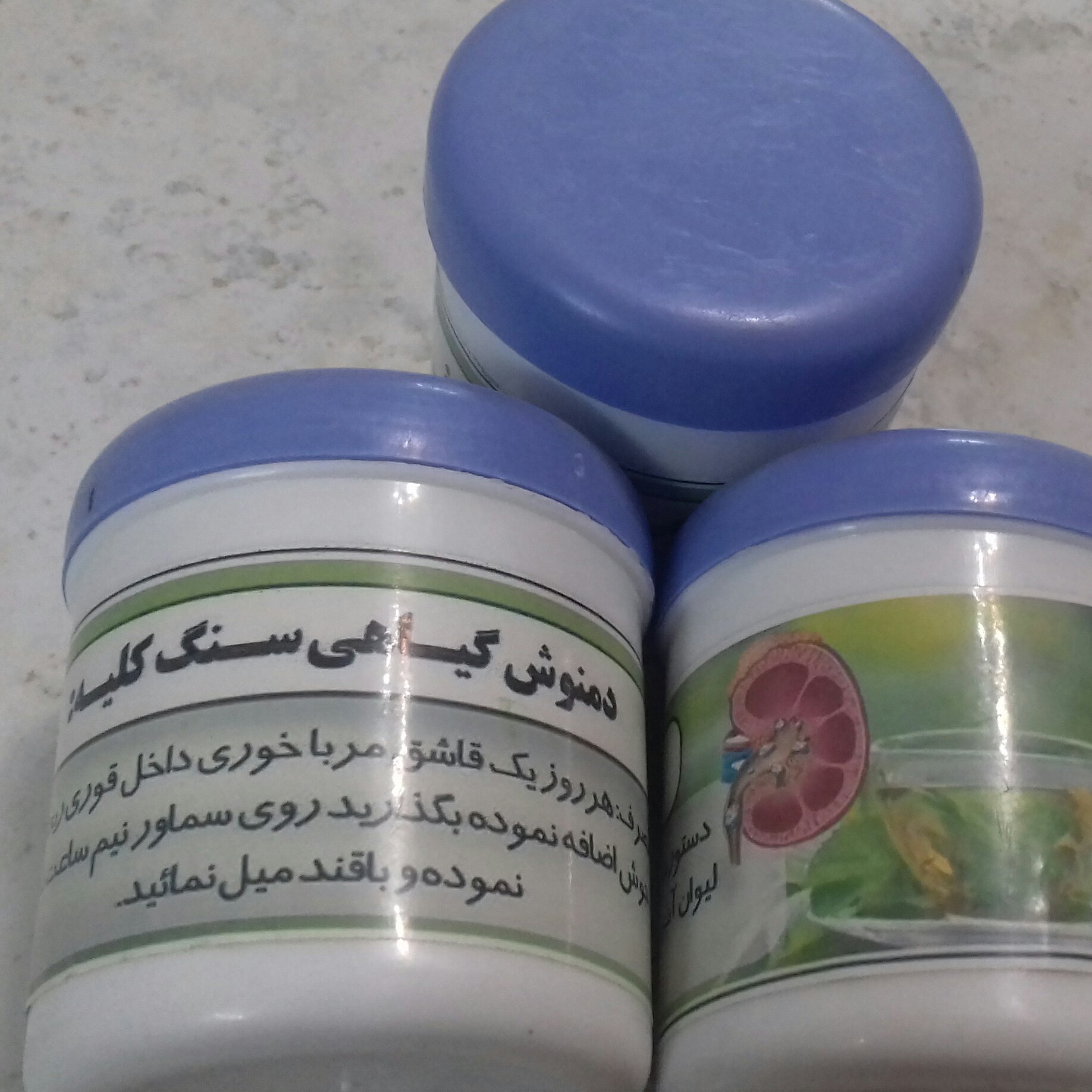 دمنوش گیاهی سنگ کلیه