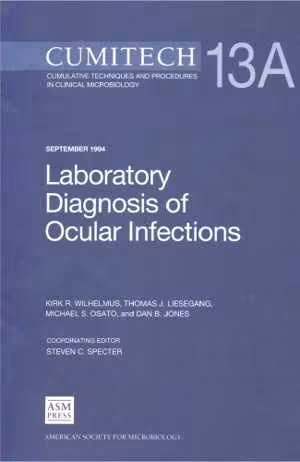 [PDF] دانلود کتاب Cumitech 13B - Laboratory Diagnosis Of Ocular Infections, 2010