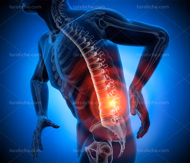 عکس کمردرد باکیفیت | گرافیک با طعم تربچه