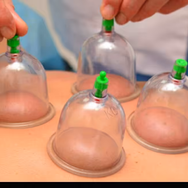 فروش بادکش طبی  79000هزارتومان ارسال به سراسر کشور  درمان دردهای عضلانی عصبی و غیره