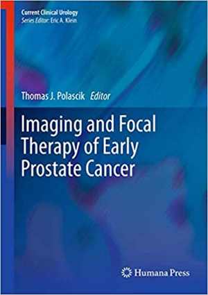 [PDF] دانلود کتاب Imaging And Focal Therapy Of Early Prostate Cancer, 2013