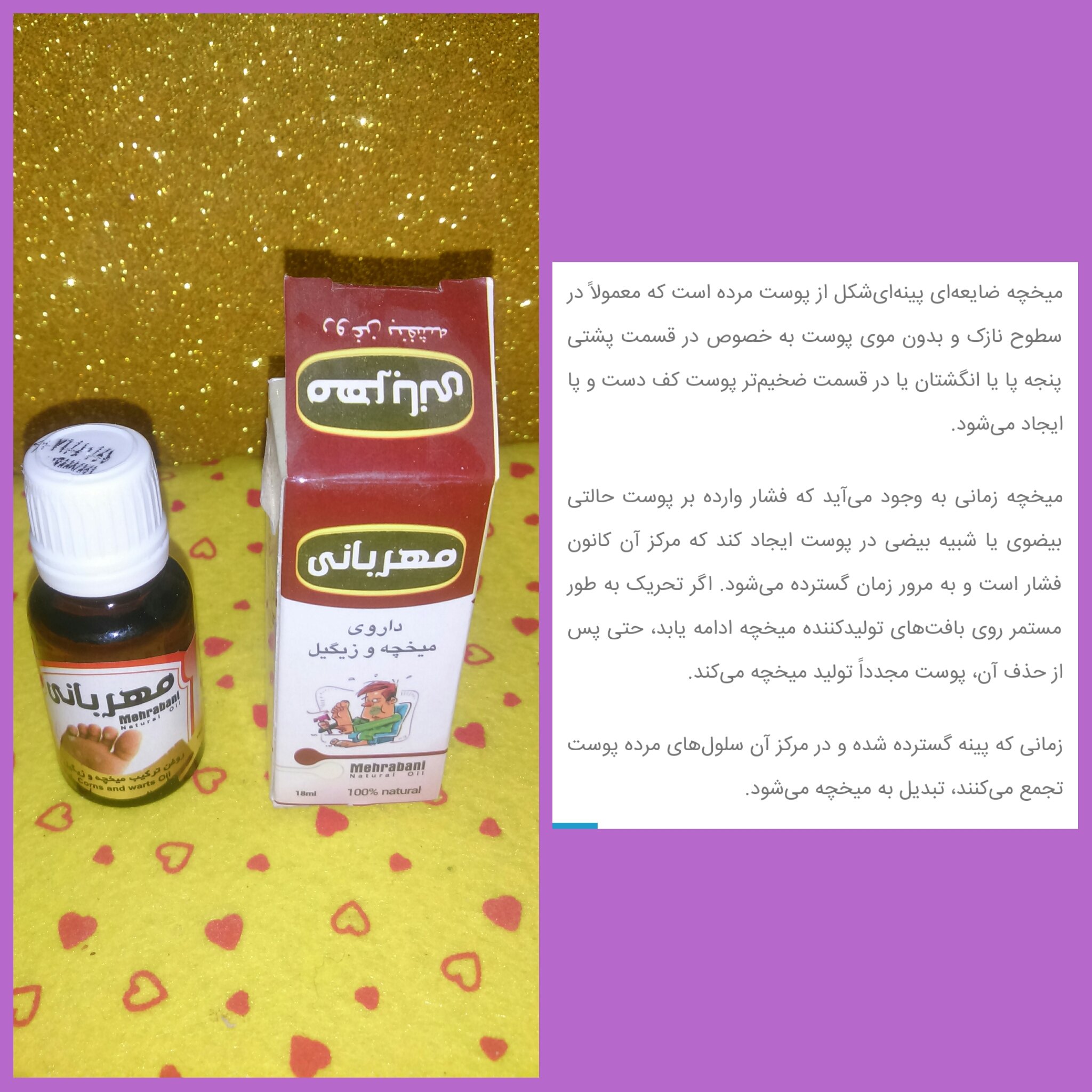 روغن میخچه و زگیل