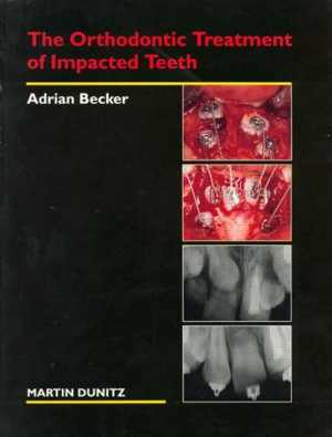 [PDF] دانلود کتاب Orthodontic Treatment Of Impacted Teeth, 1998