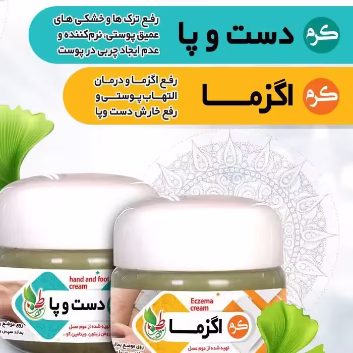 کرم اگزمای دست وصورت