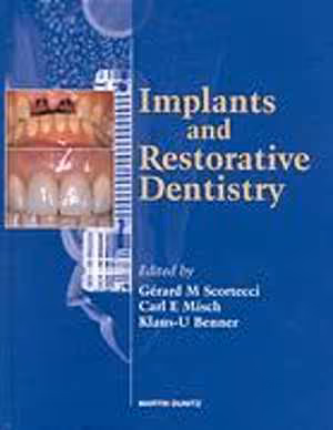 [PDF] دانلود کتاب Implants And Restorative Dentistry, 2003