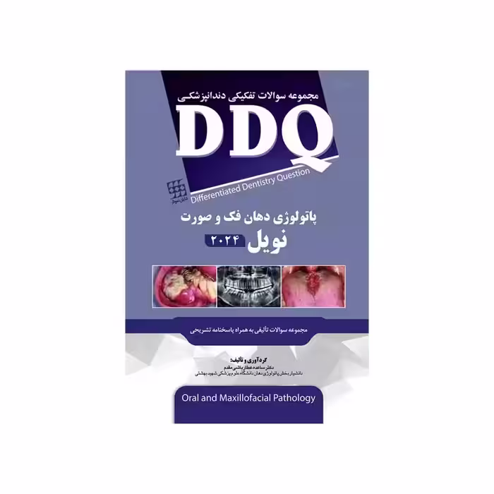 DDQ مجموعه سوالات تفکیکی دندانپزشکی پاتولوژی دهان، فک و صورت نویل 2024