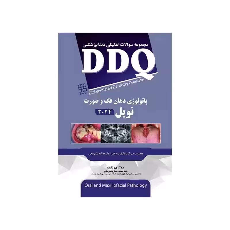 DDQ مجموعه سوالات تفکیکی دندانپزشکی پاتولوژی دهان، فک و صورت نویل 2024