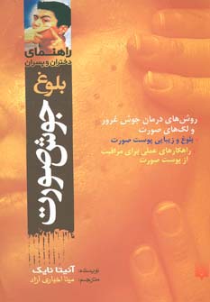 بلوغ:جوش صورت (راهنمای دختران و پسران) - ناشربوک | خرید آنلاین کتاب