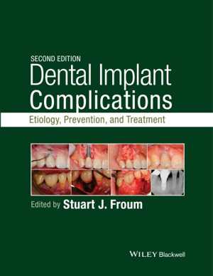 [PDF] دانلود کتاب Dental Implant Complications, 2015