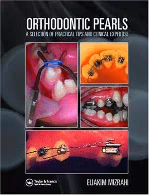 [PDF] دانلود کتاب Orthodontic Pearls A Selection Of Practical Tips And Clinical Expertise, 2004