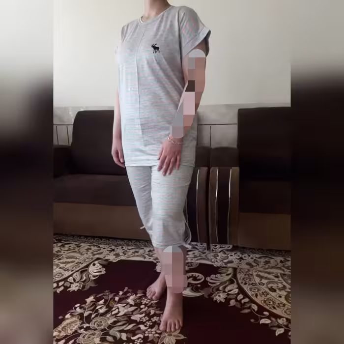 ست تیشرت و شلوارک بیلی ایلیشی جنس عالی