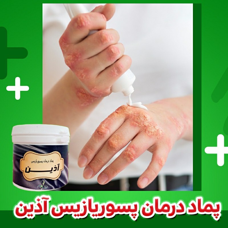 محصول گیاهی بهبود دهنده پسوریازیس 100 گرم