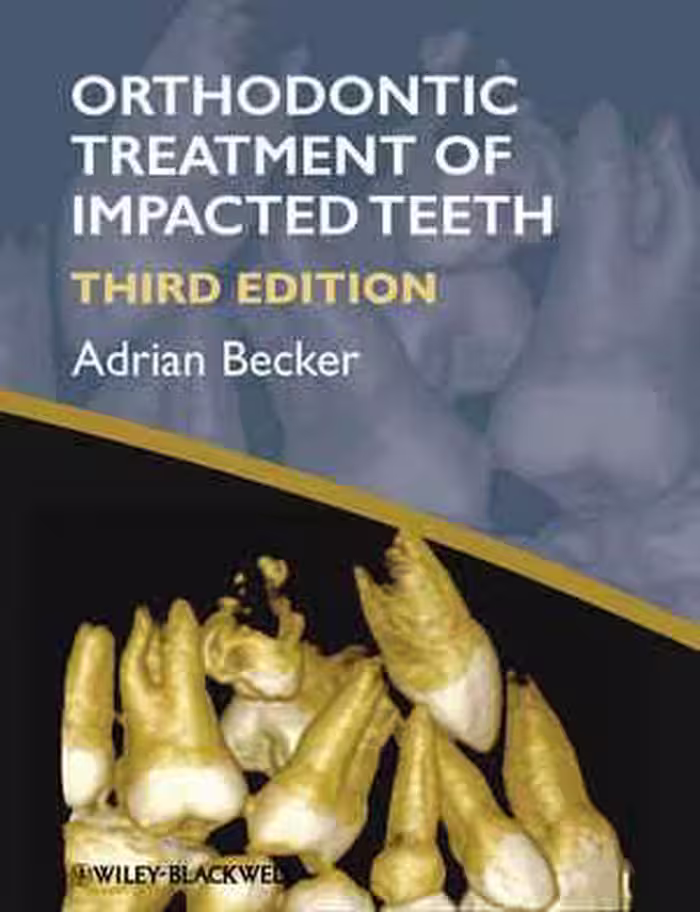 [PDF] دانلود کتاب Orthodontic Treatment Of Impacted Teeth, 2012