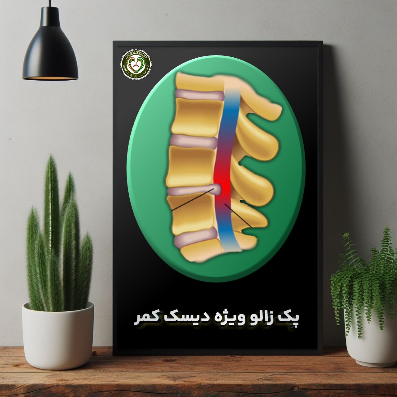 پک زالو ویژه -دیسک کمر- به همراه 14 روز مشاوره و آموزش رایگان زیر نظر متخصص طب سنتی