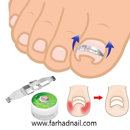 ناخن کش سگکی فلزی
