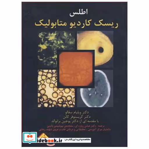 اطلس ریسک کاردیومتابولیک