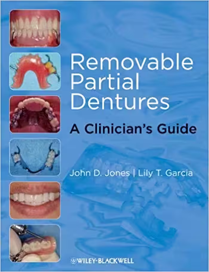 󾕇 دانلود کتاب Removable Partial Dentures A Clinician'S Guide (Restorative Dentistry), 2009 - دانلود کتاب های دانشگاهی