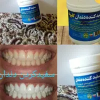 پودر سفید کننده دندان 