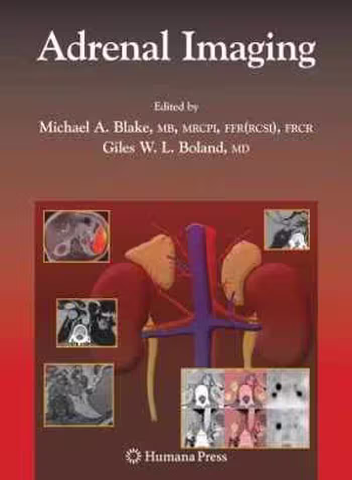 [PDF] دانلود کتاب Adrenal Imaging, 2009