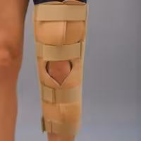 ارتز بی حرکت کننده زانو