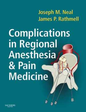 [PDF] دانلود کتاب Complications In Regional Anesthesia And Pain Medicine, 2006