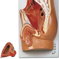 مدل (مولاژ) لگن خاصره مرد

