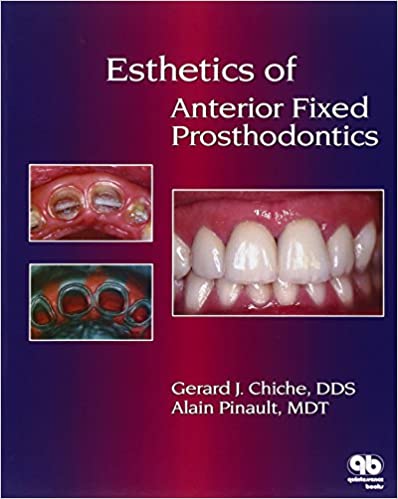  دانلود کتاب Esthetics Of Anterior Fixed Prosthodontics, 1994 - دانلود کتاب های دانشگاهی