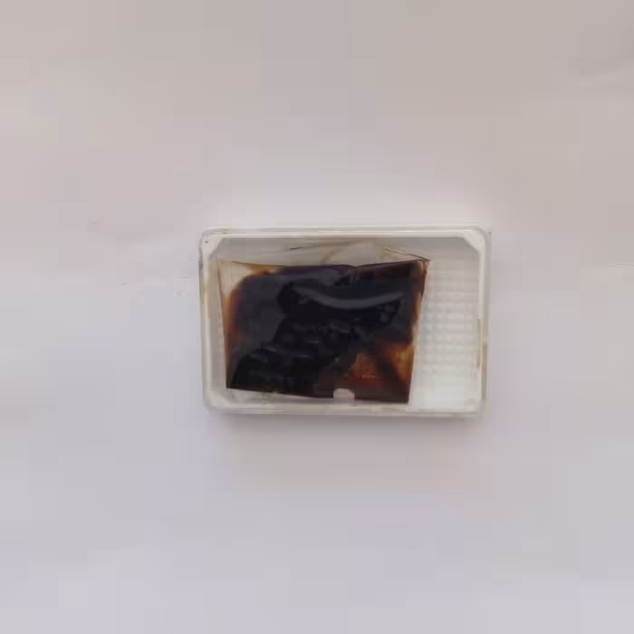 مومنایی سیاه