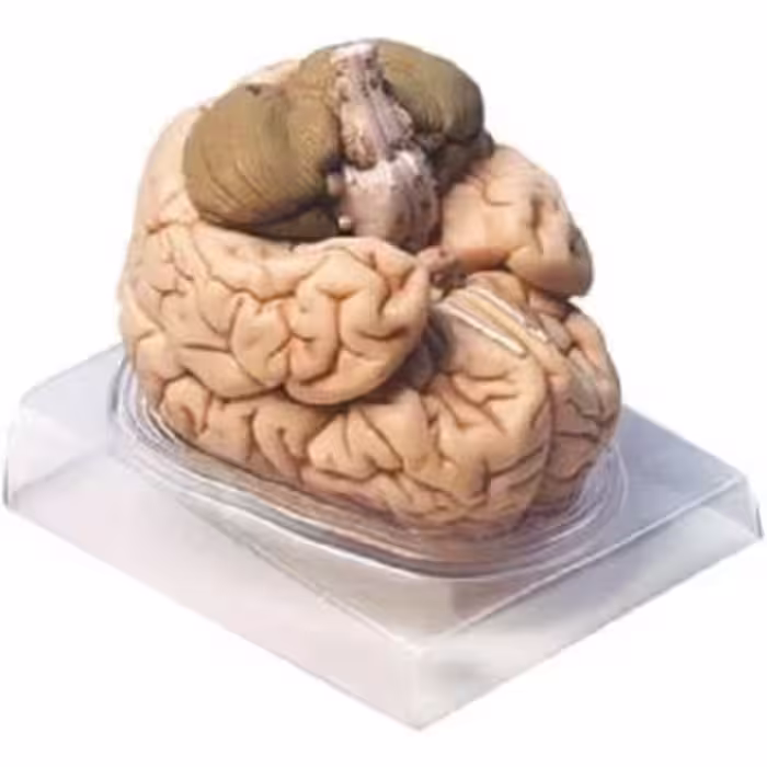 مولاژ مغز 2 قسمتی