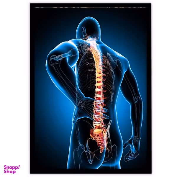 تابلو نوری بکلیت طرح رادیوگرافی نخاع و ستون فقرات مدل B-8687