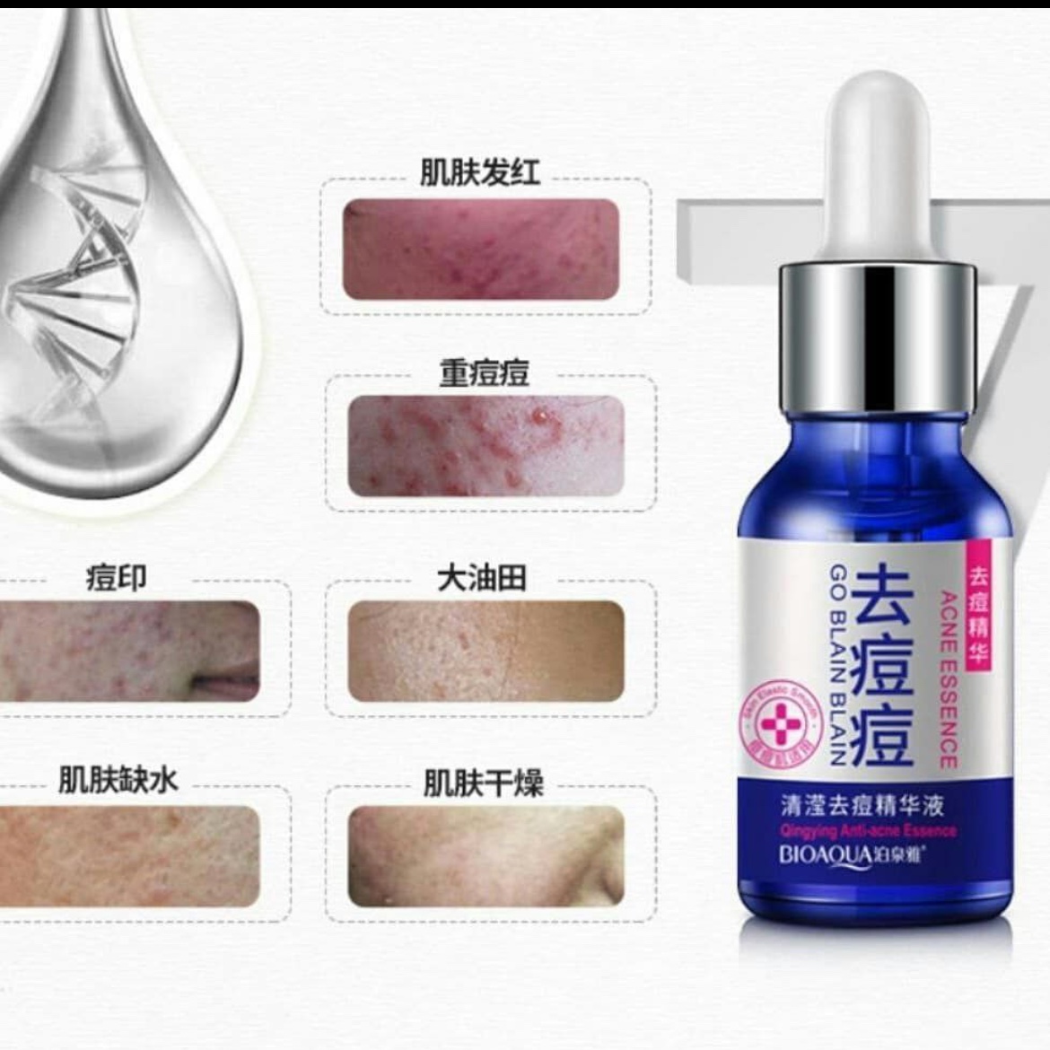 سرم پوستی ضد جوش اورجینال بیواکوا Bioaqua