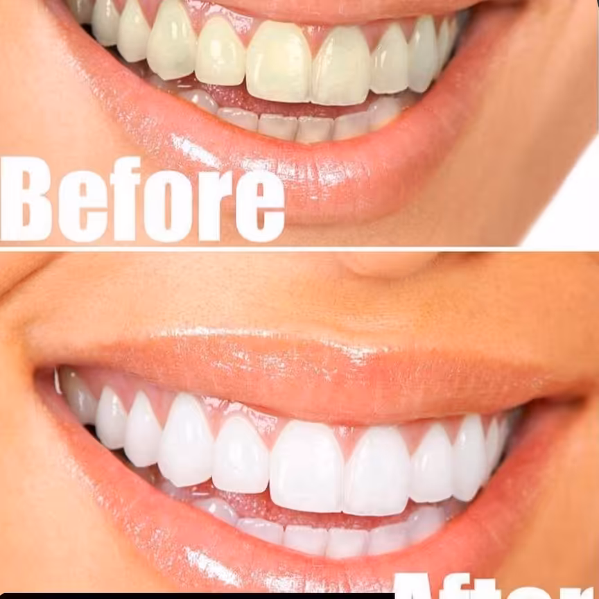 پودرسفیدکننده دندان