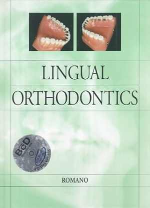 [PDF] دانلود کتاب Lingual Orthodontics, 1998