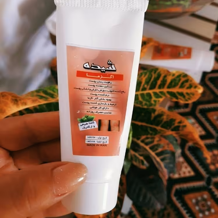 اگزمای شیده