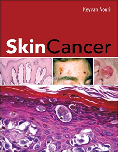  دانلود کتاب Skin Cancer, 2007 - دانلود کتاب های دانشگاهی