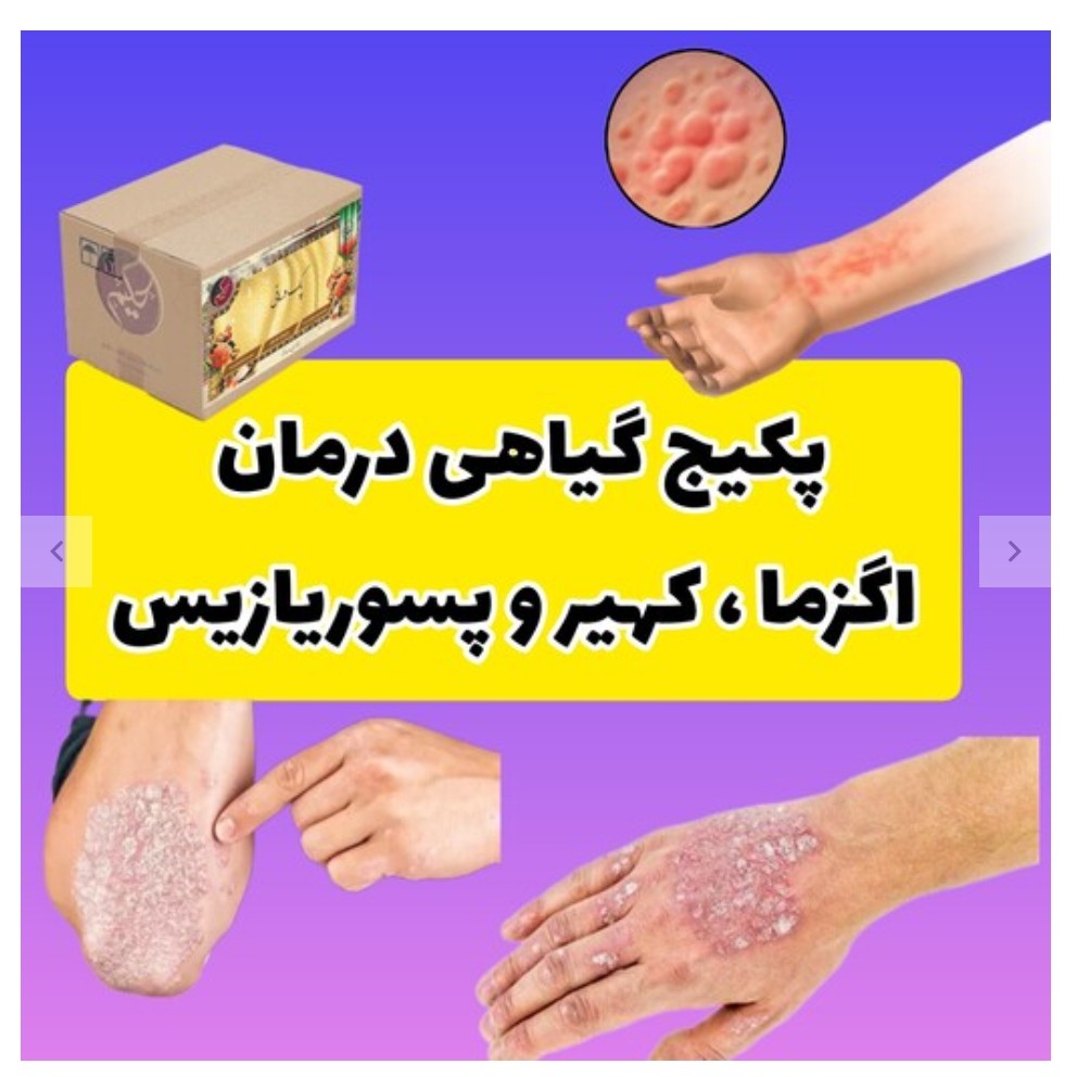 پک اگزما کهیر .پسوریازیس