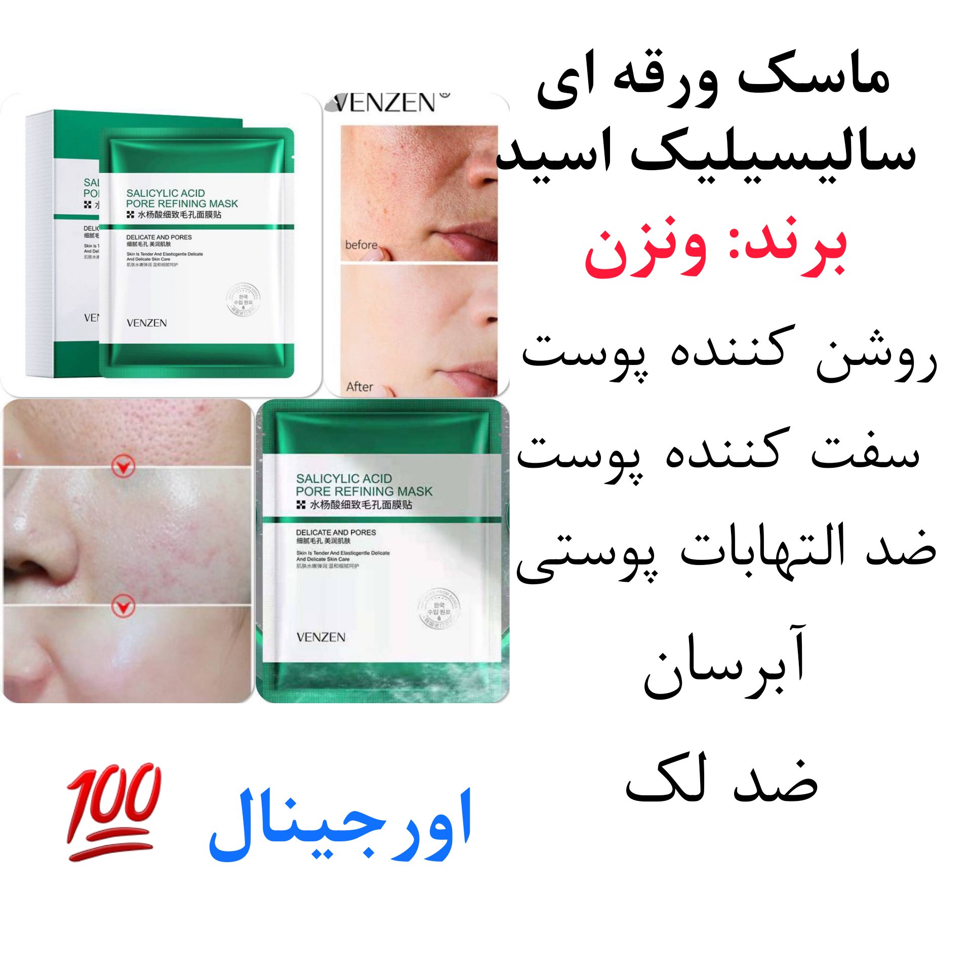 ماسک ورقه ای سالیسیلیک اسید