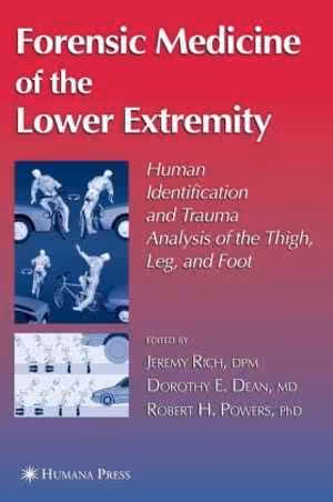 [PDF] دانلود کتاب Forensic Medicine Of The Lower Extremity, 2005
