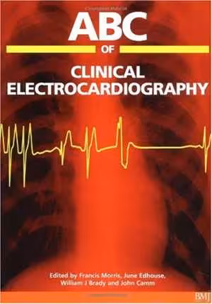 [PDF] دانلود کتاب Abc Of Clinical Electrocardiography, 2002