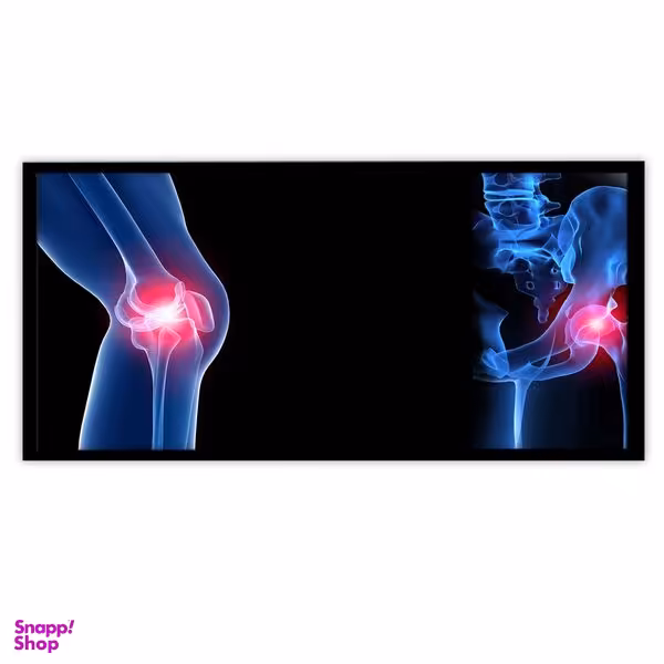 تابلو بکلیت طرح رادیوگرافی مفصل زانو مدل B-10621