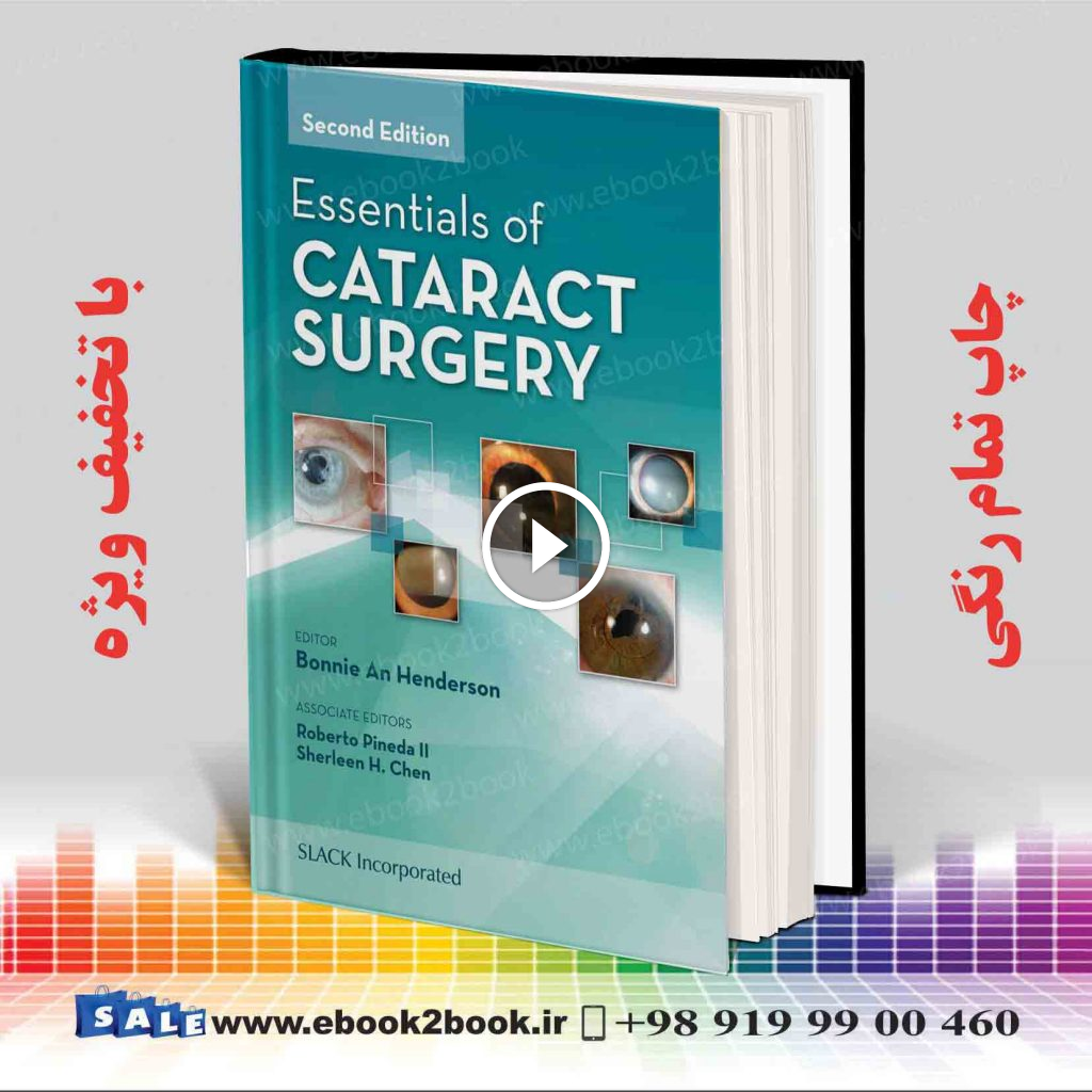 Essentials of Cataract Surgery 2nd Edition