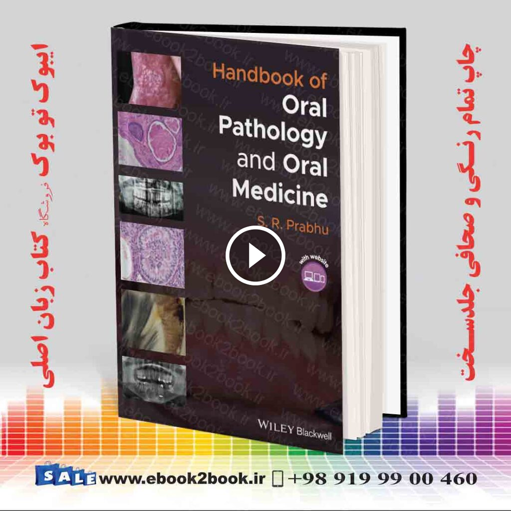 Handbook of Oral Pathology and Oral Medicine