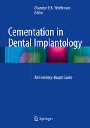 [PDF] دانلود کتاب Cementation In Dental Implantology - An Evidence-Based Guide, 2015