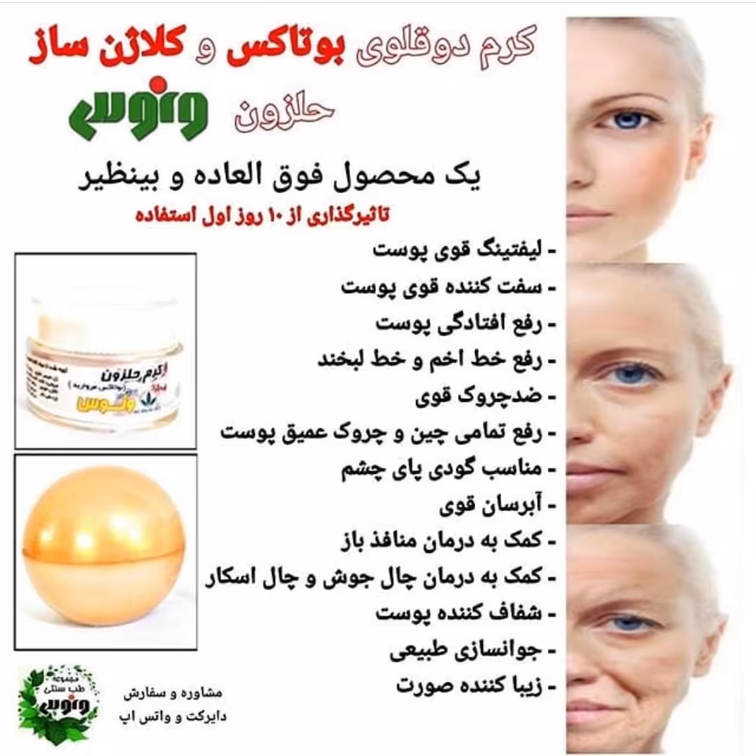 کرم دوقلوی بوتاکس