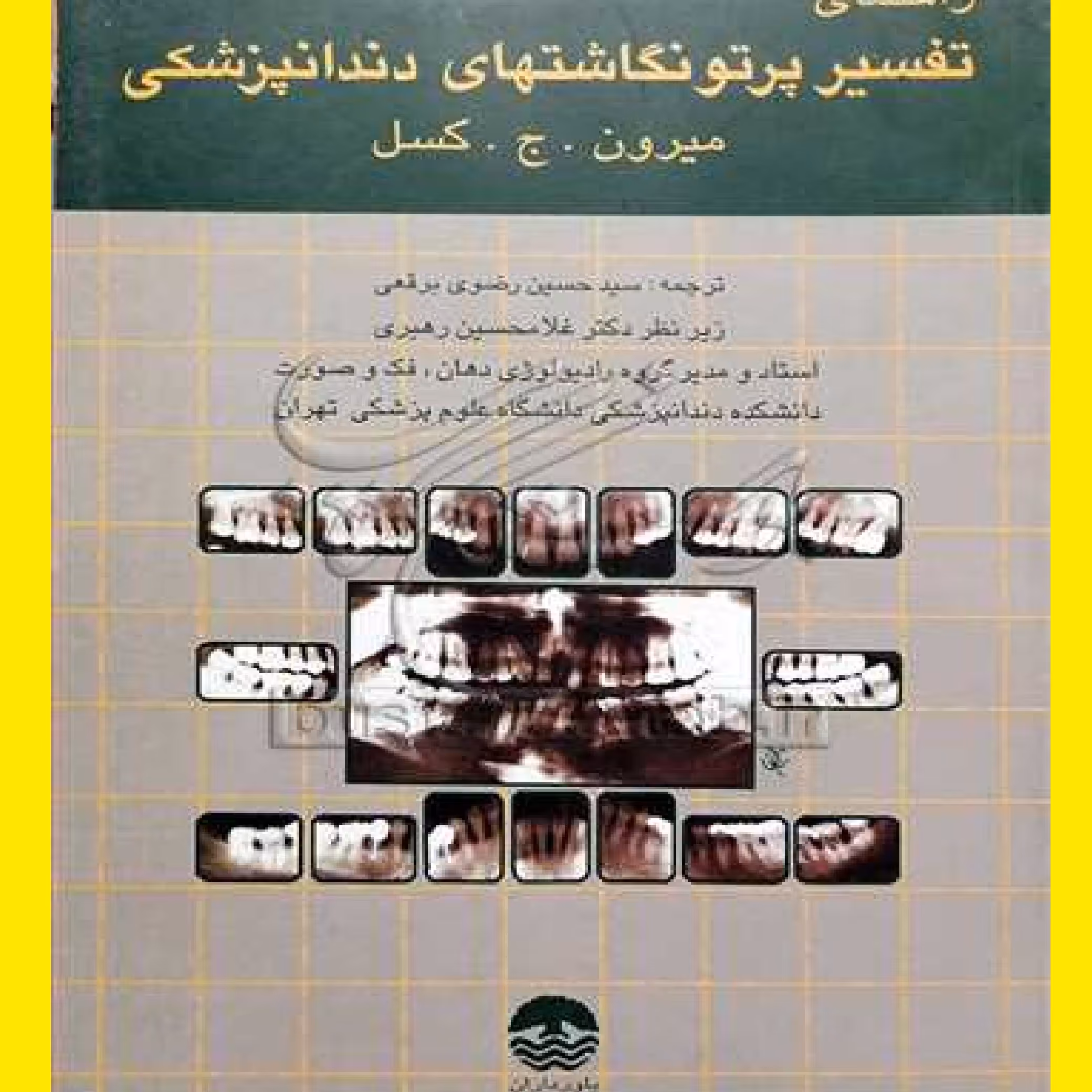 راهنمای تفسیر پرتو نگاشتهای دندانپزشکی اثر میرون کسل با ترجمه رضوی برقعی