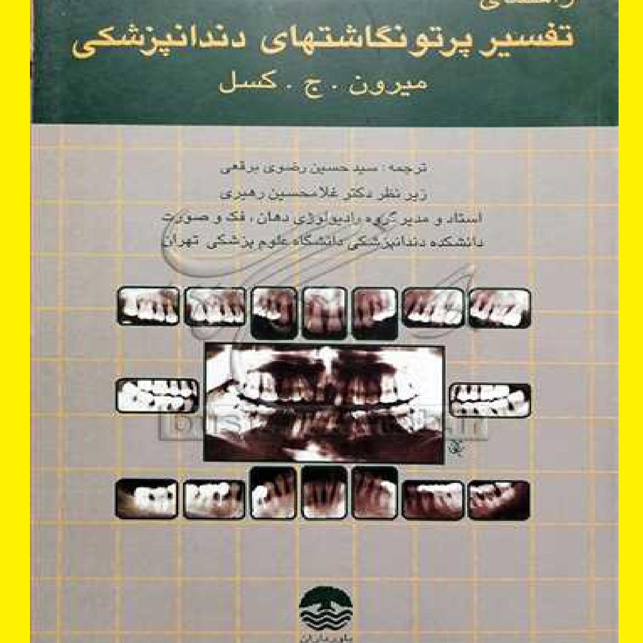 راهنمای تفسیر پرتو نگاشتهای دندانپزشکی اثر میرون کسل با ترجمه رضوی برقعی