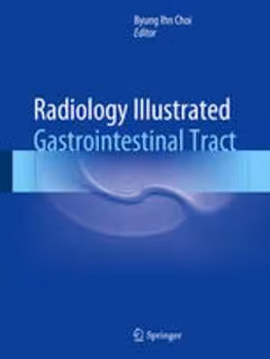 [PDF] دانلود کتاب Radiology Illustrated - Gastrointestinal Tract, 2015
