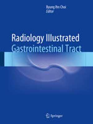 [PDF] دانلود کتاب Radiology Illustrated - Gastrointestinal Tract, 2015