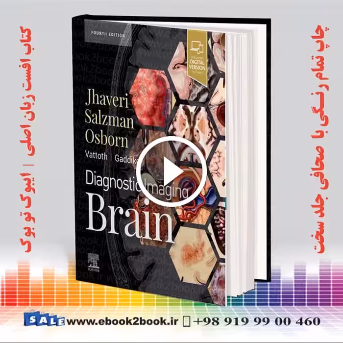Diagnostic Imaging: Brain 4th Edition | 2020